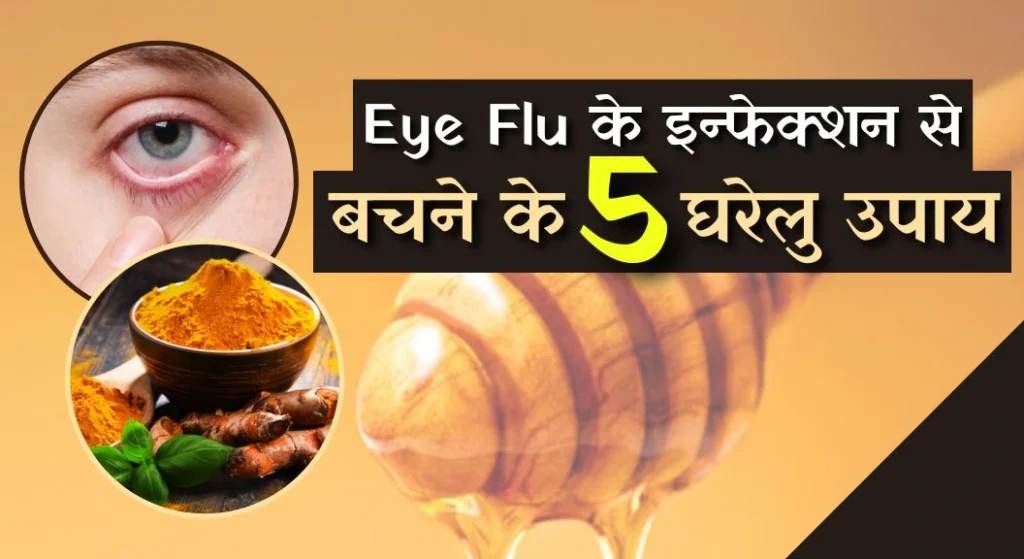 Eye Flu Home Remedies